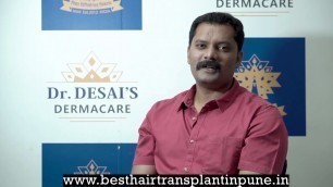 'Tanaji movie fame Actor Sagar Pabale\'s Hair Transplant feedback at IIAM HT Clincs'